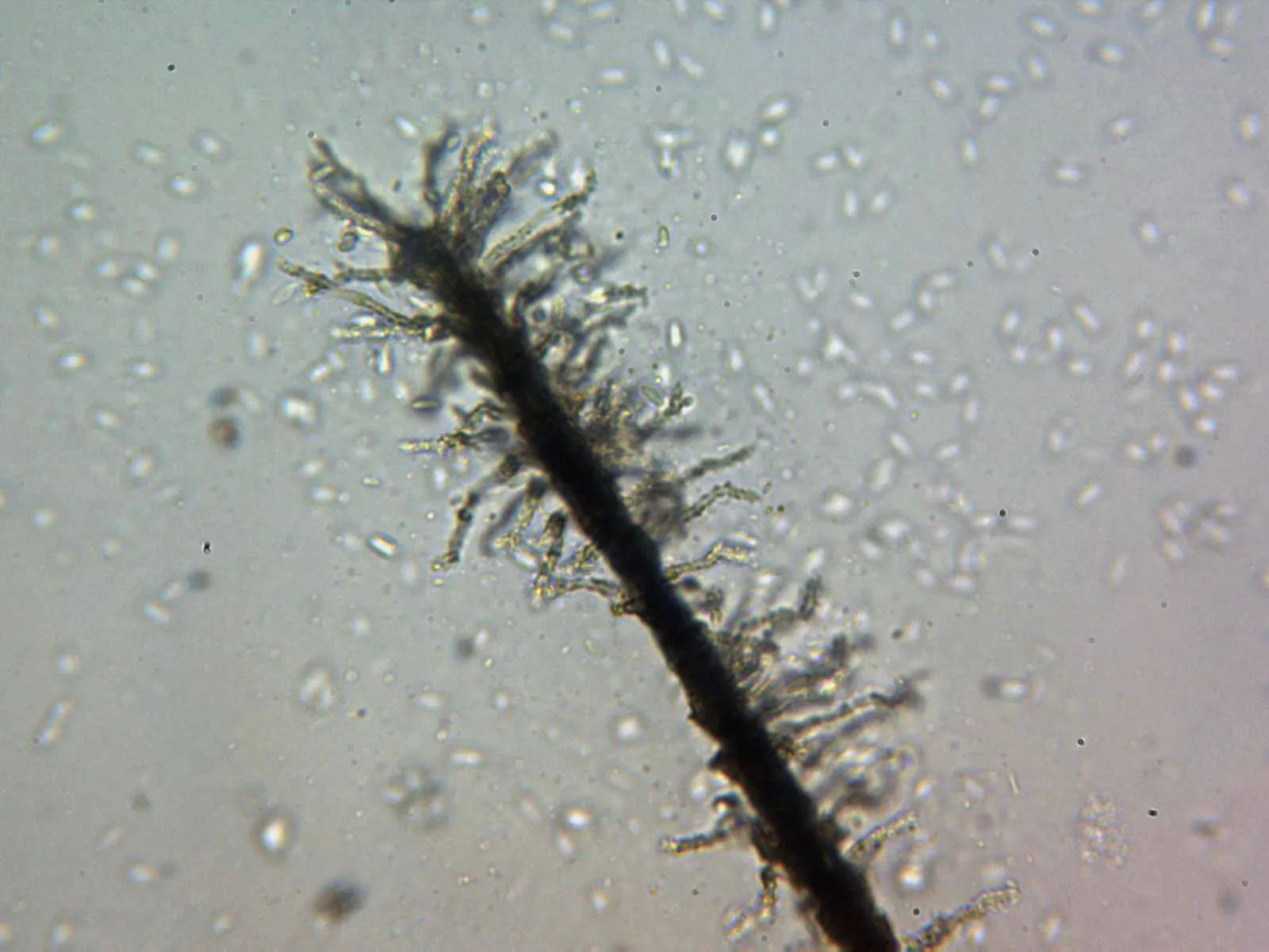 Microscopía de Phaeoisaria clematidis - 10 - X 400 agua